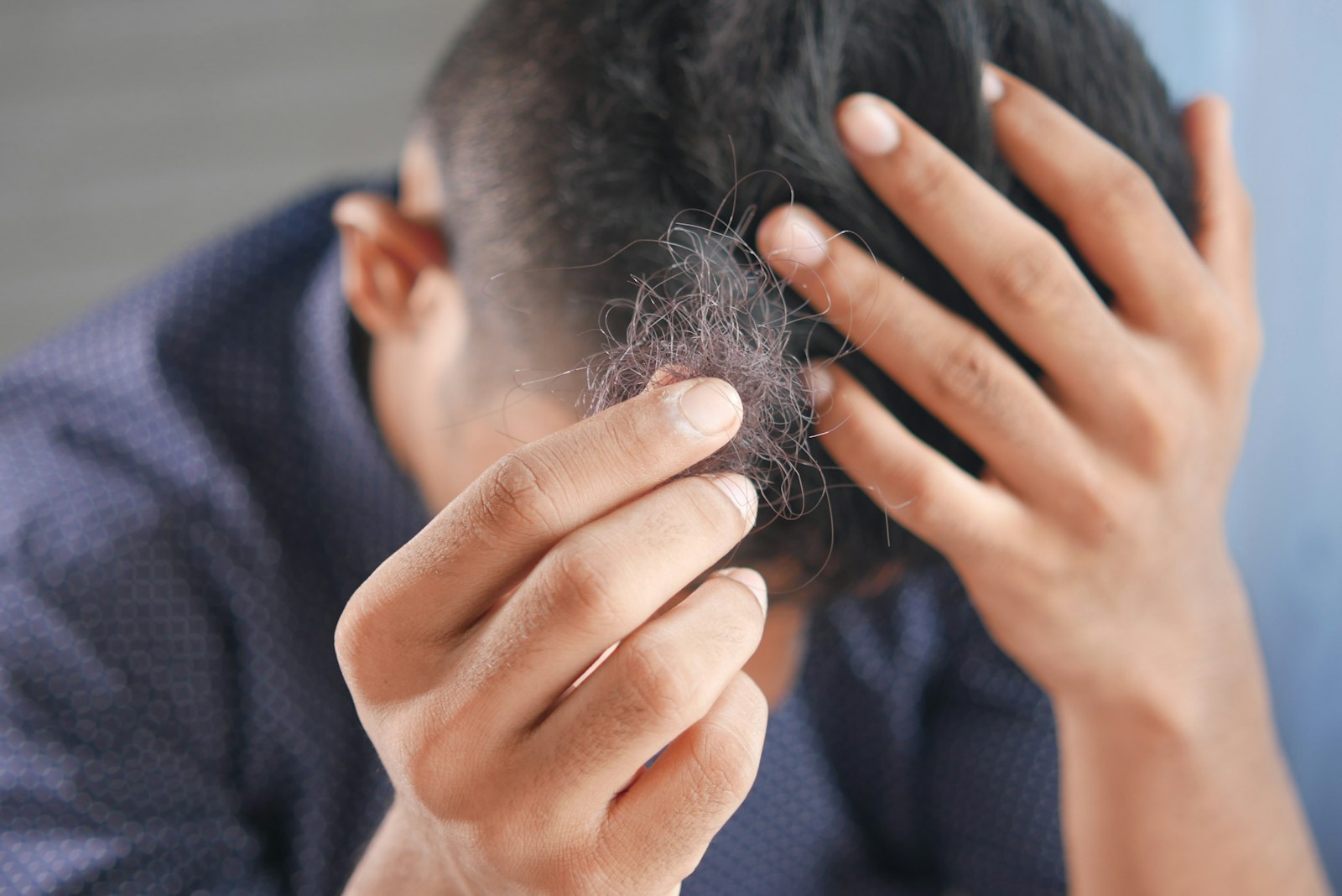 Female Pattern Hair Loss Programme